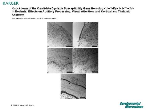 Knockdown Of The Candidate Dyslexia Susceptibility Gene Homolog