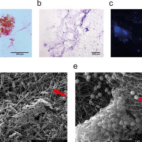 Characterization Of Biofilm Formation In The Collagen Matrix P