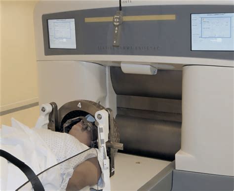 RadiocirugÍa Gamma Knife Una SoluciÓn Ambulatoria Para DiagnÓsticos