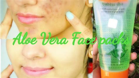 Patanjali Aloe Vera Face Packs To Remove Dark Spots Acne Scars