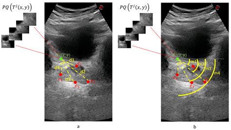 Applied Sciences Free Full Text Estimation Of The Prostate Volume From Abdominal Ultrasound