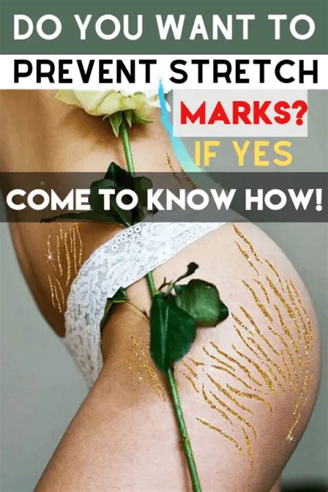 How To Prevent Stretch Marks Mum And Them