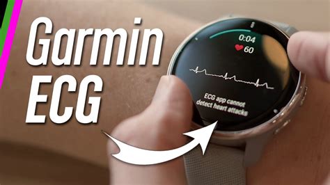 Garmin Smartwatches Revive ECG Functionality With Recent Updates And