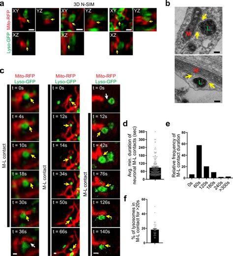 Mitochondrialysosome Contacts Dynamically Form In Human Neurons A