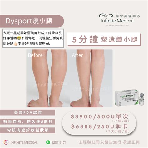 【infinite Medical】dysport Botox Siax Xeomin肉毒桿菌 瘦肩瘦小腿瘦面 Queen Concept