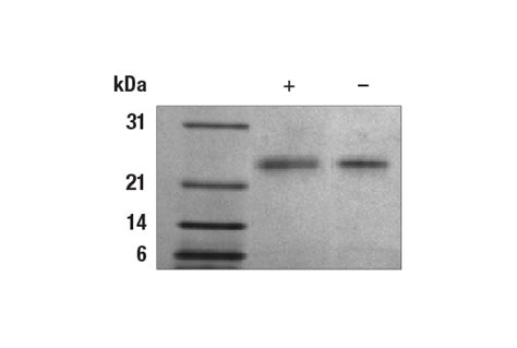 Human Sonic Hedgehog Shh Recombinant Protein Cell Signaling Technology