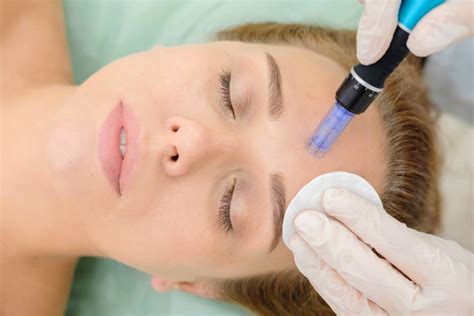 The Pros And Cons Of Microneedling Houston Tx