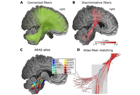 Delineation Of Cm Dbs Structural Network Connectivity A All Fibers