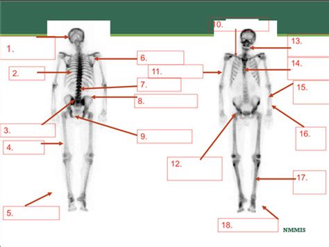 Radiology Aandp Skeletal System Flashcards Quizlet