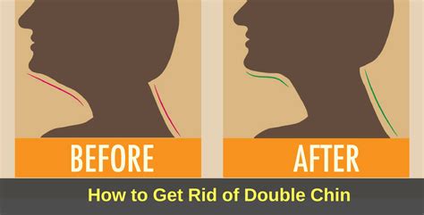 double chin how to get rid of