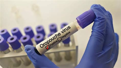 Sloth fever symptoms explained – everything we know about Oropouche