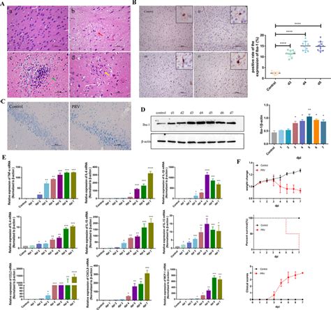 PRV Infection Induces Microglial Activation And Neuroinflammation In