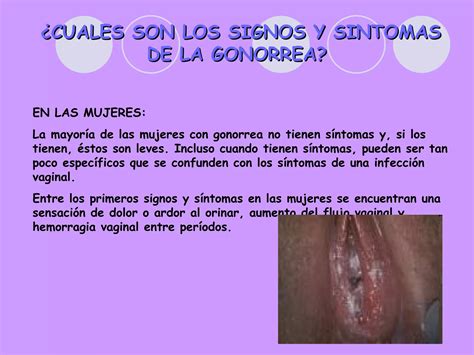 Enfermedades De Transmision Sexual Ppt