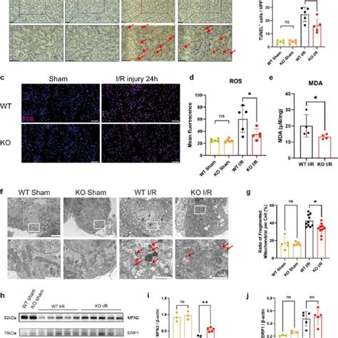 Lrrk2 Aki Mice Exhibit Less Mitochondrial Injury Together With