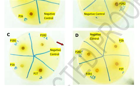 Photographs Of Agar Plates Showing Inhibition Zones In Antifungal Test