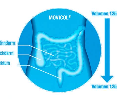 Movicol Anwendung Tipps und Tricks für richtige Einnahme