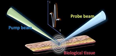 Photoacoustic Remote Sensing Microscopy For Lipid Imaging