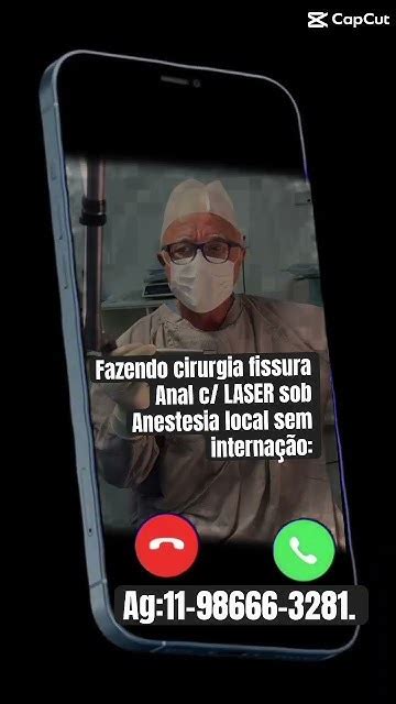 Proctologista Fazendo Cirurgia C Laser P Fissura Anal Sob Anestesia