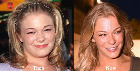 Leann Rimes Plastic Surgery Before And After Photos Latest Plastic Surgery Gossip And News