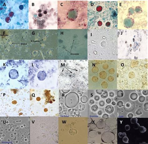 Blastocystis Hominis Histology