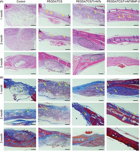 The He A And Masson B Staining Observations Of Bone Regeneration In Download Scientific