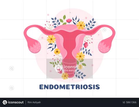 Endometriosis Illustration Free Download Healthcare And Medical Illustrations Iconscout