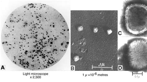 Smallpox Microscope