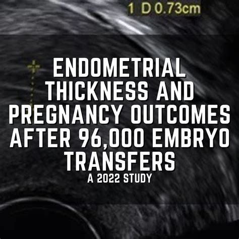 Endometrial Thickness And Pregnancy Outcomes After 96 000 Embryo