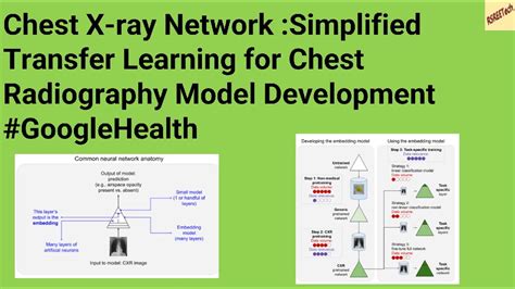 Chest X Ray Network Simplified Transfer Learning For Chest Radiography