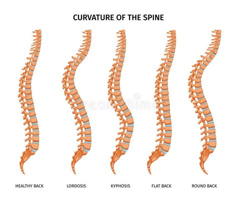 spine curvature anatomy set stock vector illustration  physical