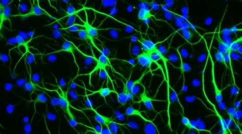 Come Generare Nuovi Neuroni Nel Cervello Popular Science