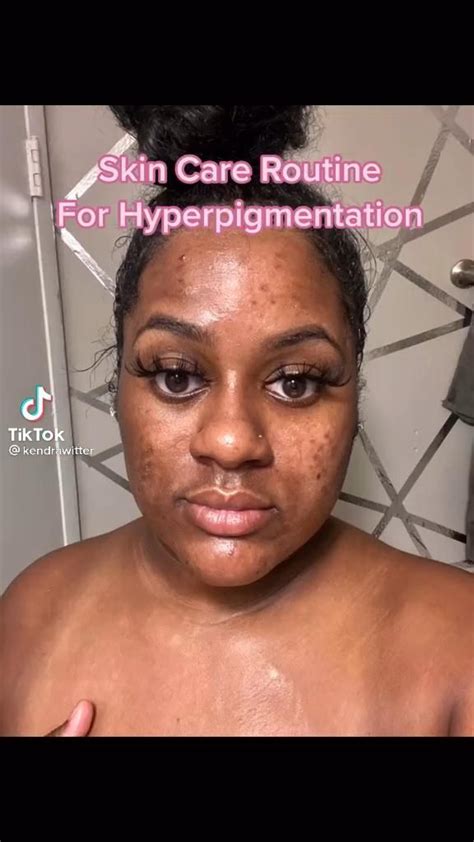 Get Rid Dark Spots On Your Face And Body Artofit