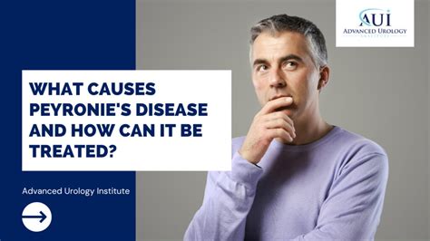 What Causes Peyronie's Disease and How Can It Be Treated? | Advanced Urology Institute