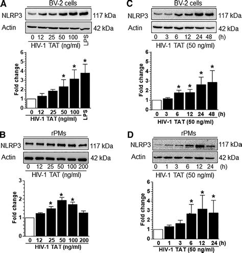 Hiv Tat Primes And Activates Microglial Nlrp Inflammasome Mediated