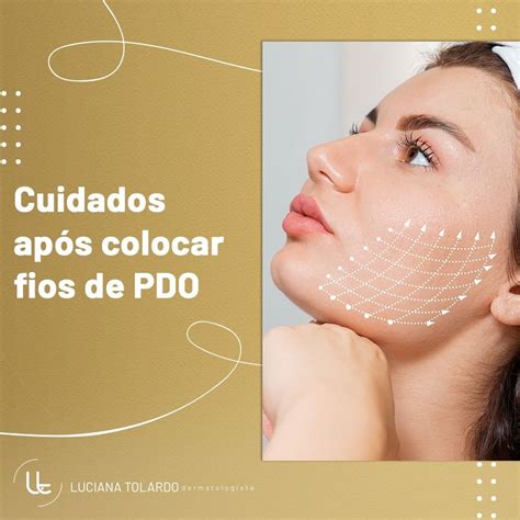 Cuidados Ap S Colocar Fios De Pdo Dra Luciana Tolardo