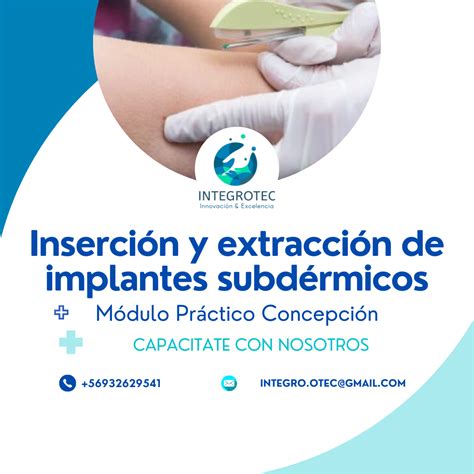 Inserción y Extracción de Implantes Subdérmicos Implanon Jadelle