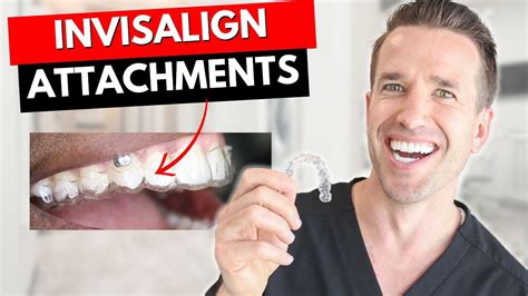 Dont Get Invisalign Attachments Before Watching This Dr Nate Youtube