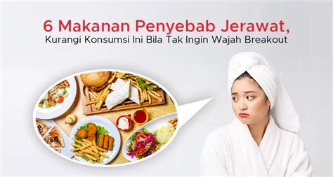 Hati Hati Makanan Penyebab Jerawat Ini Perlu Dibatasi Indonesian Buku