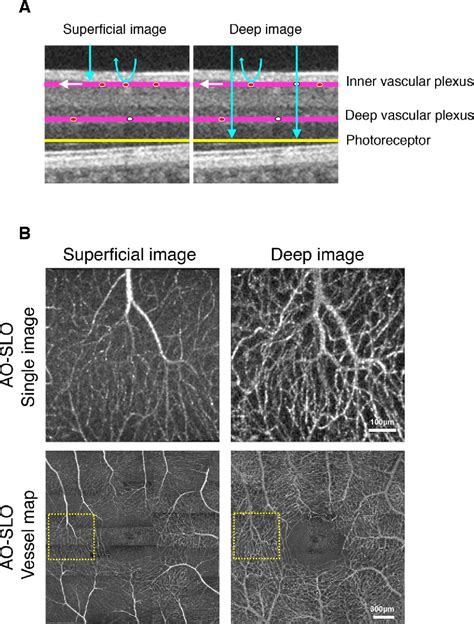 Figure From Imaging Of Retinal Vascular Layers Adaptive Optics