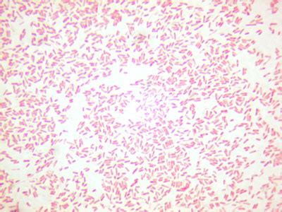 Biol Lab Manual Gram Negative Rod