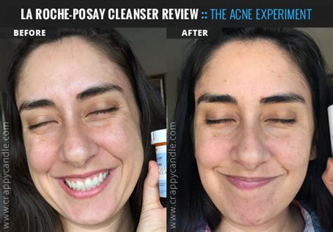 La Roche-Posay Toleriane Hydrating Gentle Cleanser Review - The Acne ...