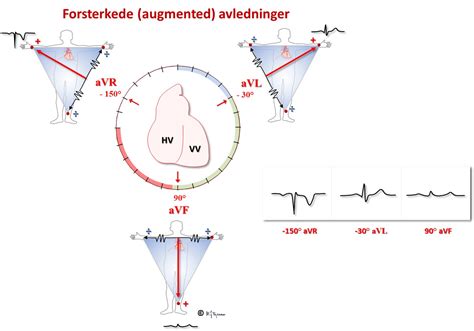 Index Of Elaring Fag Hjertesykdommer Spl Ekg Del Images