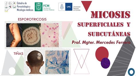 Micosis Superficiales y Subcutáneas YouTube