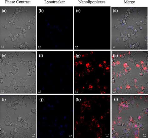 Uptake Of Nanolipoplexes In Live Macrophages A D Untreated Control