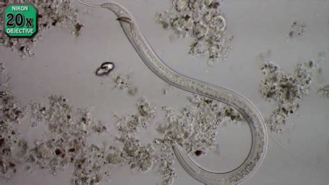 Nematode Necator Americanus Youtube