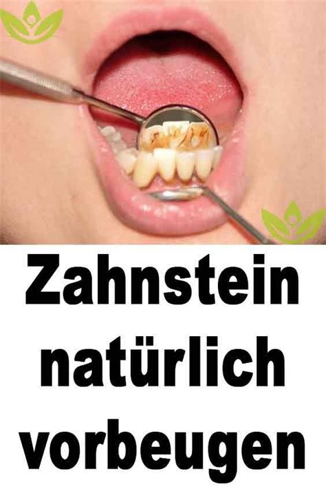 Zahnstein Nat Rlich Vorbeugen Zahnstein Z Hne Zahnstein Entfernen