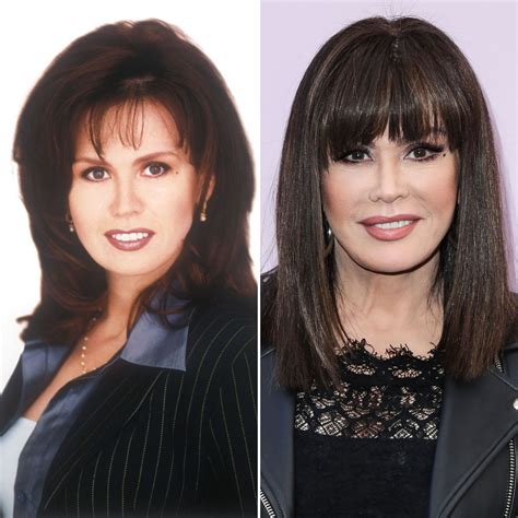 MARIE OSMOND PLASTIC SURGERY: HOW DID SHE MAINTAIN HER YOUTHFUL LOOKS