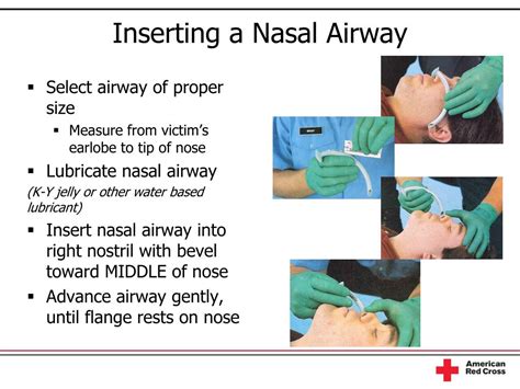 Ppt Airway Management Powerpoint Presentation Free Download Id5921479