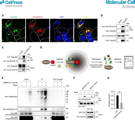 Figure 2 From S Acylation Of P62 Promotes P62 Droplet Recruitment Into