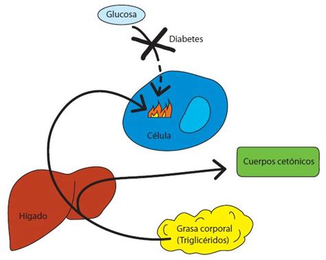 El Autocontrol De Los Cuerpos Cetónicos En Personas Con Diabetes Imagazine Soluciones Para